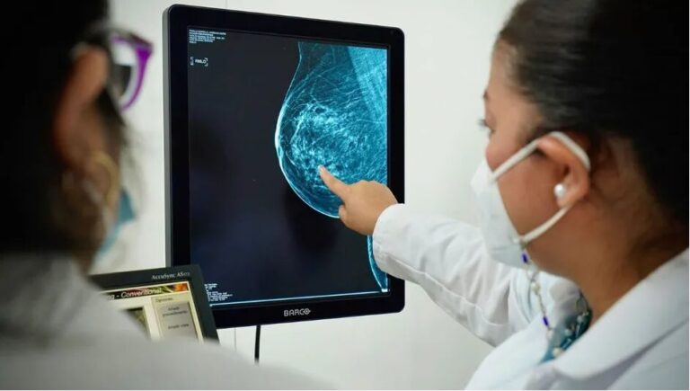 Mueren 51 por cáncer de mama