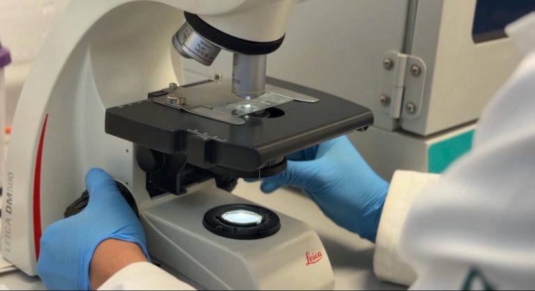 UIBMZ referente en vigilancia epidemiológica de tuberculosis