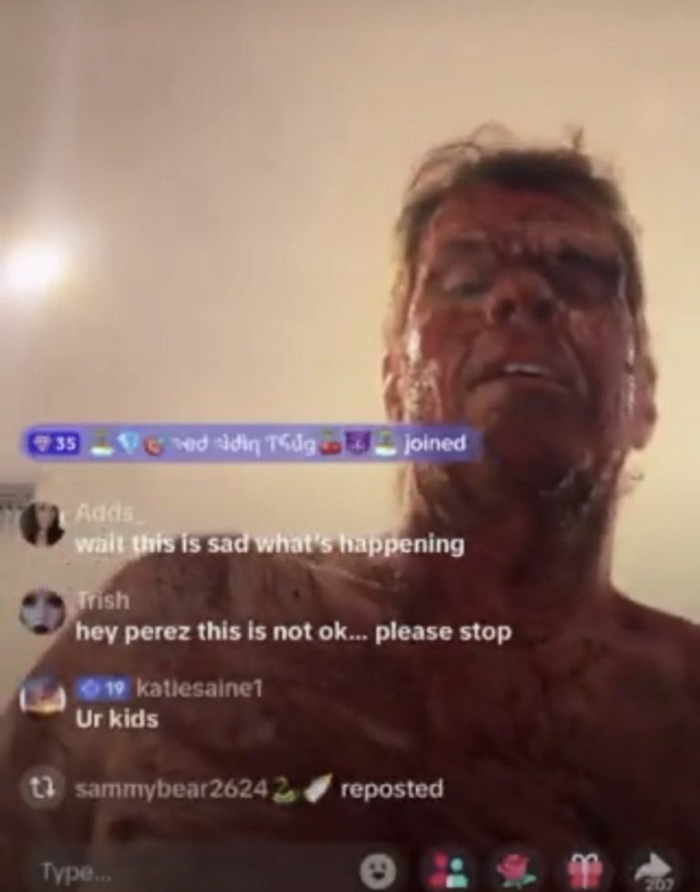 Hospitalizan a Perez Hilton tras aparecer herido en TikTok